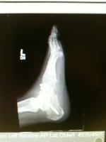 foot3.jpg